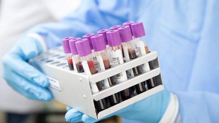 Седем новооткрити случая на туберкулоза в област Шумен от началото на 2025 г.