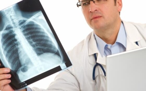 Учени: Има потенциална връзка между хроничния риносинузит и рак