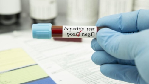 СЗО: Светът изостава в борбата срещу хепатита
